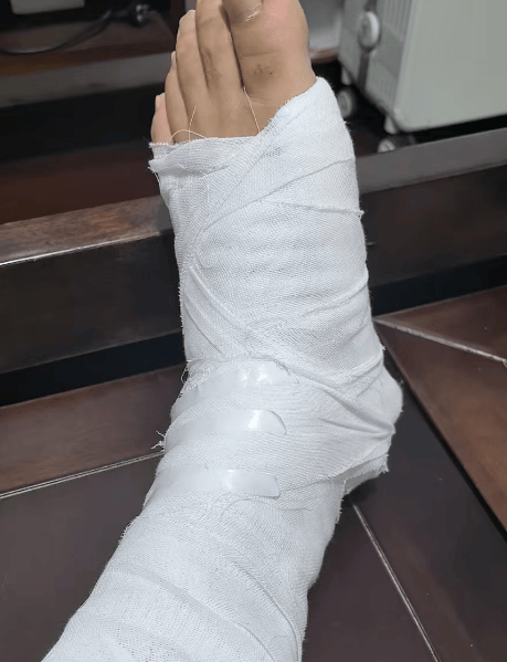 民警在公墓抓獲一嫌疑人<strong></p>
<p>宏鑫機(jī)械設(shè)備有限公司
</strong>，查獲假發(fā)、人臉面具……:宏鑫機(jī)械設(shè)備有限公司
